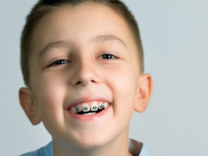Promociones dentales en Cuernavaca del Consultorio Dental Zmile