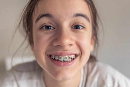 Promociones dentales en Cuernavaca del Consultorio Dental Zmile