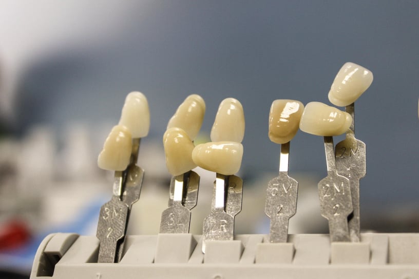 Promociones dentales en Cuernavaca del Consultorio Dental Zmile