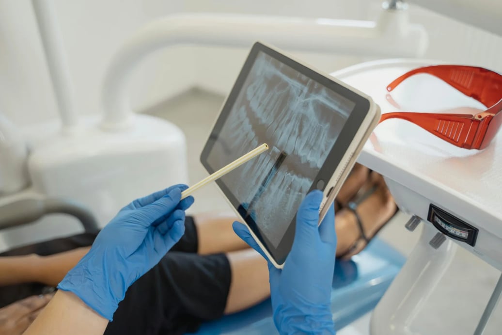 Promociones dentales en Cuernavaca del Consultorio Dental Zmile